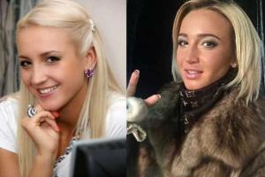 Ольга Бузова увеличила себе губы?