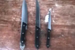 Житель Ровенщины колол кабана и упал грудью на нож