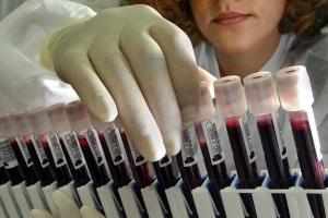 В Дании обнаружен случай заболевания вирусом Зика