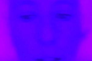 Ксения Собчак показала фиолетовое лицо