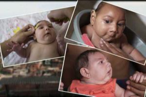 Бразилия планирует разработать вакцину от вируса Зика через год