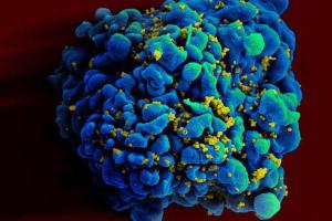 Американские ученые смогли удалить ВИЧ из инфицированных клеток человека