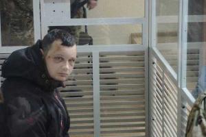 Краснову одели электронный браслет в реанимации