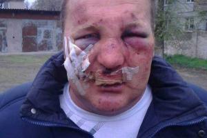 В Запорожской области зверски избили члена Радикальной партии