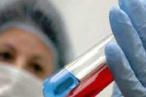 Россию захлестнула загадочная болезнь страшнее СПИДа - медицина бессильна