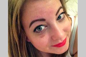 Британка потратила 17 тысяч долларов на операции ради селфи