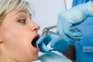 В США умерла женщина после удаления 16 зубов у стоматолога