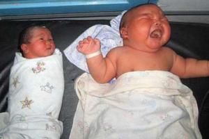 В Индонезии родился младенец, который шокировал всех врачей