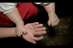 В Китае родился ребенок с 31 пальцем