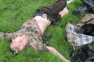 На Киевщине полиция нашла изуродованное тело мужчины (18+)