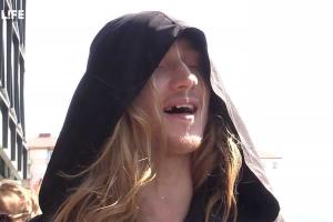 У участника "Евровидения" от Беларуси IVAN'а в 21 год выпадают молочные зубы