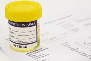 Ученые из Японии разработали метод диагностики рака по анализу мочи 