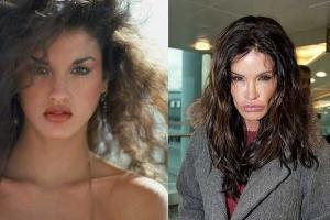 Топ-10 звезд, которые не смогли красиво постареть