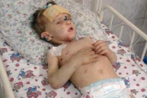 Нашлись родные найденного в Одессе полуживого мальчика