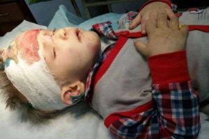 Найденный в Одессе полуживой ребенок вспомнил свое имя 