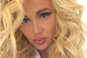 Губы Виктории Лопыревой превратились в пельмени