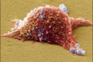 Впервые биологи смогли проследить, как развивается рак кожи