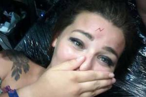Фанатка "Гарри Поттера", изрядно выпив, сделала себе татуировку на лбу