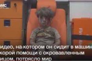 Видео с раненым после бомбежки мальчиком потрясло весь мир (18+)