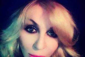 Ирина Билык шокировала своим лицом