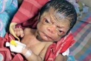 В Сети появилось шокирующее видео с родившимся в Бангладеш ребенком с лицом 90-летнего старика