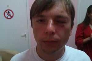 Журналист из "Стоп коррупции" вместо интервью получил удар в лицо