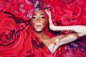 Нестандартные модели, которые ломают стереотипы о красоте