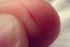 Ученые рассказали, почему порезы от бумаги настолько болезненны