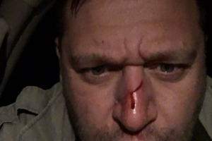 Михаил Добкин получил ранение во время отстрела свиней