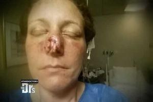 В США неадекватный молодой человек откусил своей девушке нос