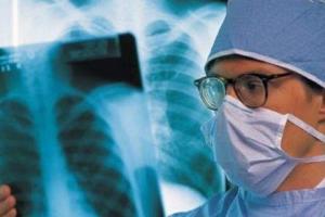 Вченим вдалося встановити, що саме поширювало туберкульоз