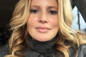 Дана Борисова напугала поклонников осунувшимся лицом