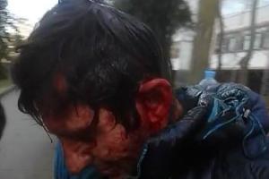 Кровавое видео избиения крымчан бойцами "самообороны" шокировало Интернет (18+)