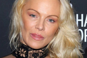 Памелу Андерсон изуродовали пластические операции