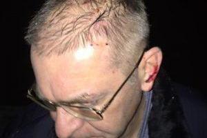 Советник главы МВД: Пашинский был вынужден применить оружие