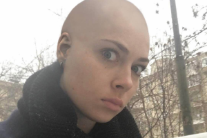 Настасья Самбурская из-за своей популярности лишилась волос