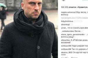 Лысый Дмитрий Нагиев признался, что скучает за шевелюрой