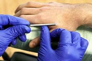 В Бельгии сотрудникам компании вживили под кожу электронные "ключи"