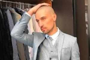 Дима Билан полностью облысел: фанаты переживают за его здоровье