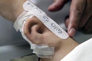 Врачи из Китая вырастили на руке мужчины новое ухо