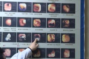 У жительницы Китая в желудке выросли грибы