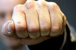 Женщину-режиссера из России жестоко избили в Париже: несколько дней она провела в реанимации