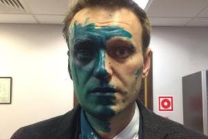 Навальному выдали загранпаспорт, но запретили выезжать за пределы России