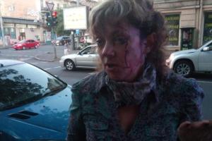 Появилось видео, как в центре Одессы избили известную активистку
