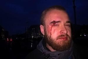 В Киеве жестоко избили известного «киборга»: опубликованы снимки нападавшего