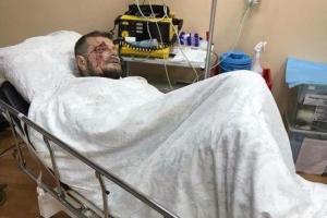 "Для них было бы лучше, чтобы я умер": Мосийчук лично будет вести следствие по делу о теракте