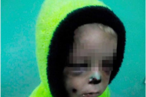В Житомирской области мать избила своего 2-летнего ребенка
