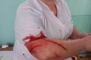 В России в поликлинике пациентка исполосовала врача ручкой: подробности