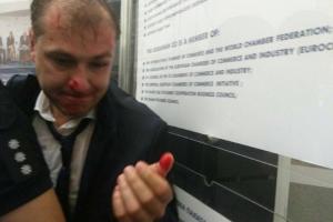 В Киеве националисты сорвали съезд политической партии и побили заместителя ее председателя