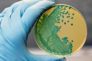 В Украину пришла смертельная болезнь: кто в группе риска